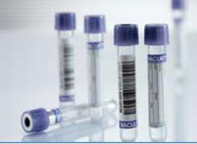 Vacuette® Venous Blood Collection Tube, 4 mL, 13 x 75 mm