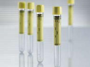 Vacuette® Urinalysis Tube, 9 mL, 16 x 100 mm