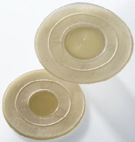 FLANGE, NONCONVEX STD 17MM F/AC PED OSTOMY (10/BX)