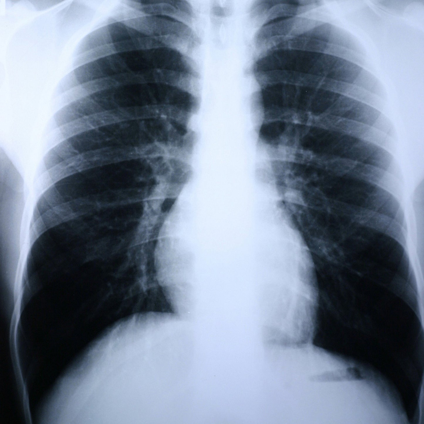 FILM, XRAY GRN 8X10 (100/BX)