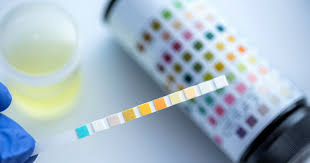 Urinalysis