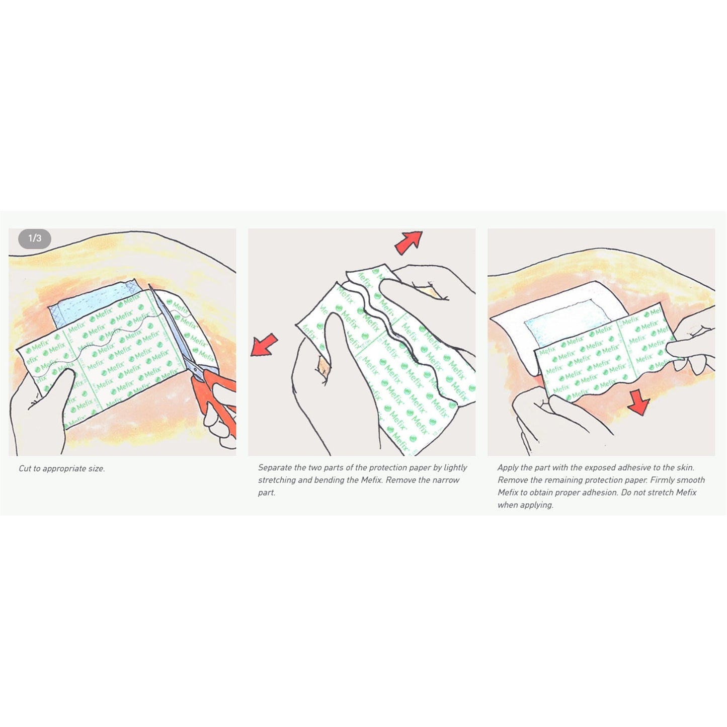 Mefix® Nonwoven Dressing Retention Tape, 2 Inch x 11 Yard