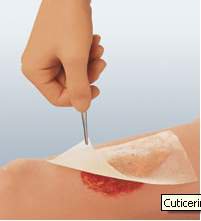 Cuticerin Oil Emulsion Impregnated Dressing, 3 x 8 Inch