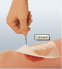 DRESSING, CUTICERIN GAUZE 8"X16" (25/BX 6BX/CS)