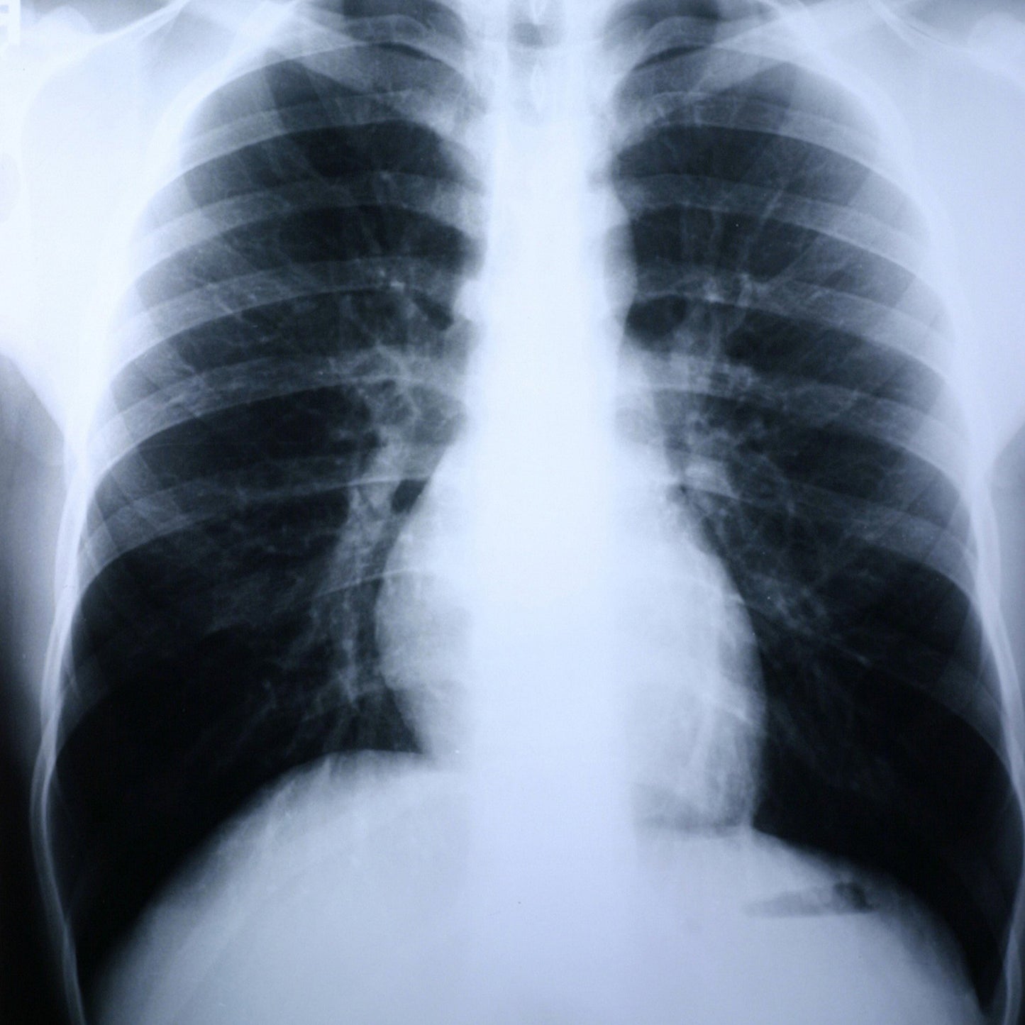 Clear Choice™ Performance X-Ray Film