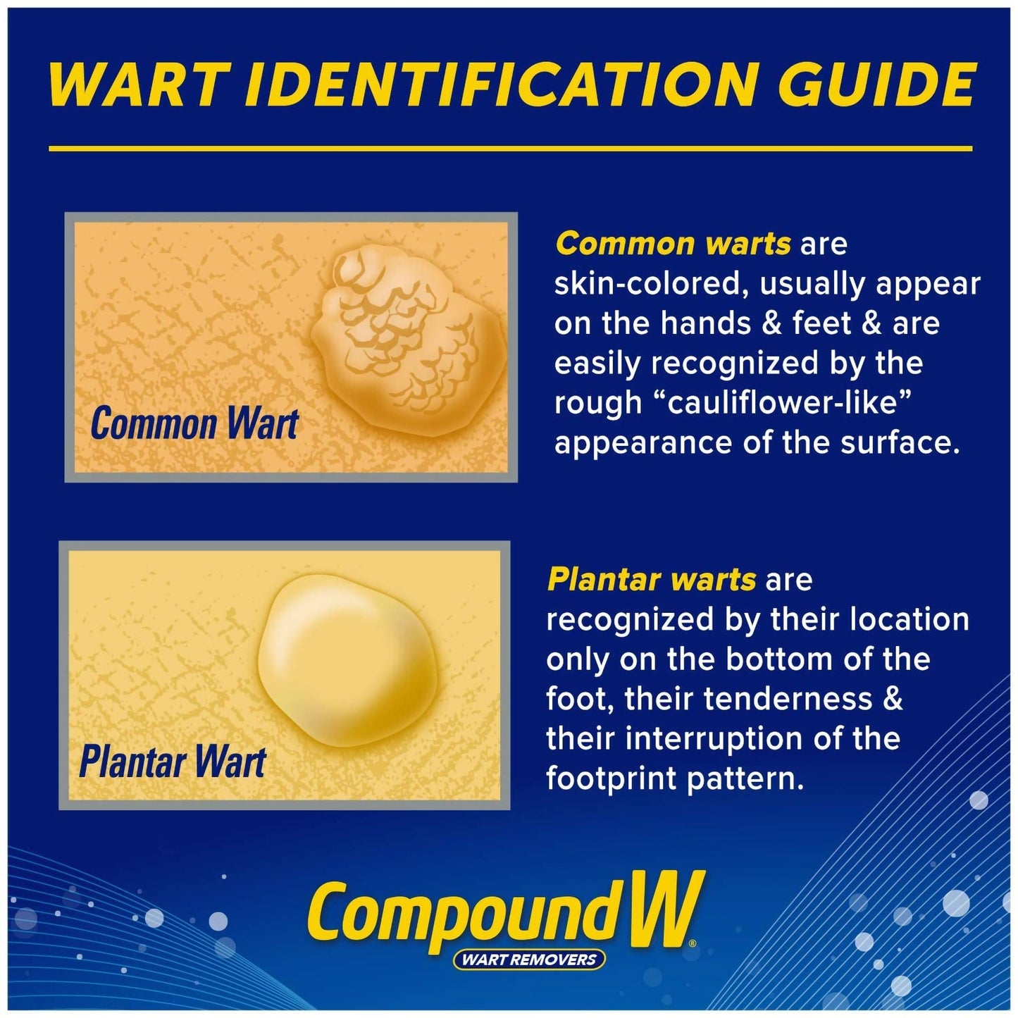 COMPOUND W, SPR FREEZE OFF 8APPL