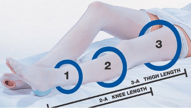 CAP® Thigh High Anti-embolism Stockings, Extra Large / Short