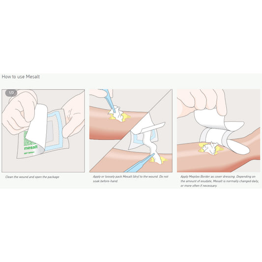 Mesalt® Sodium Chloride Impregnated Dressing, 4 x 4 Inch / 2 x 2 Inch Folded