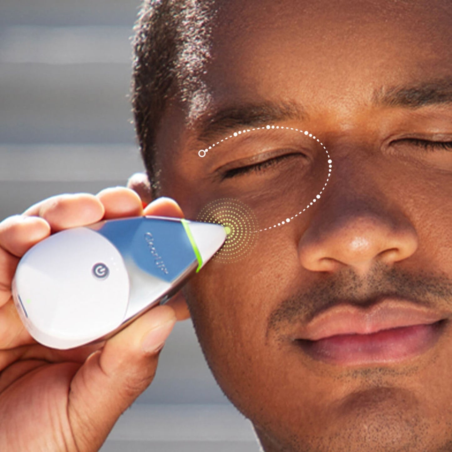 DEVICE, BIOELECTRONIC CLEARUP 2.0 SINUS PAIN (100/CS)