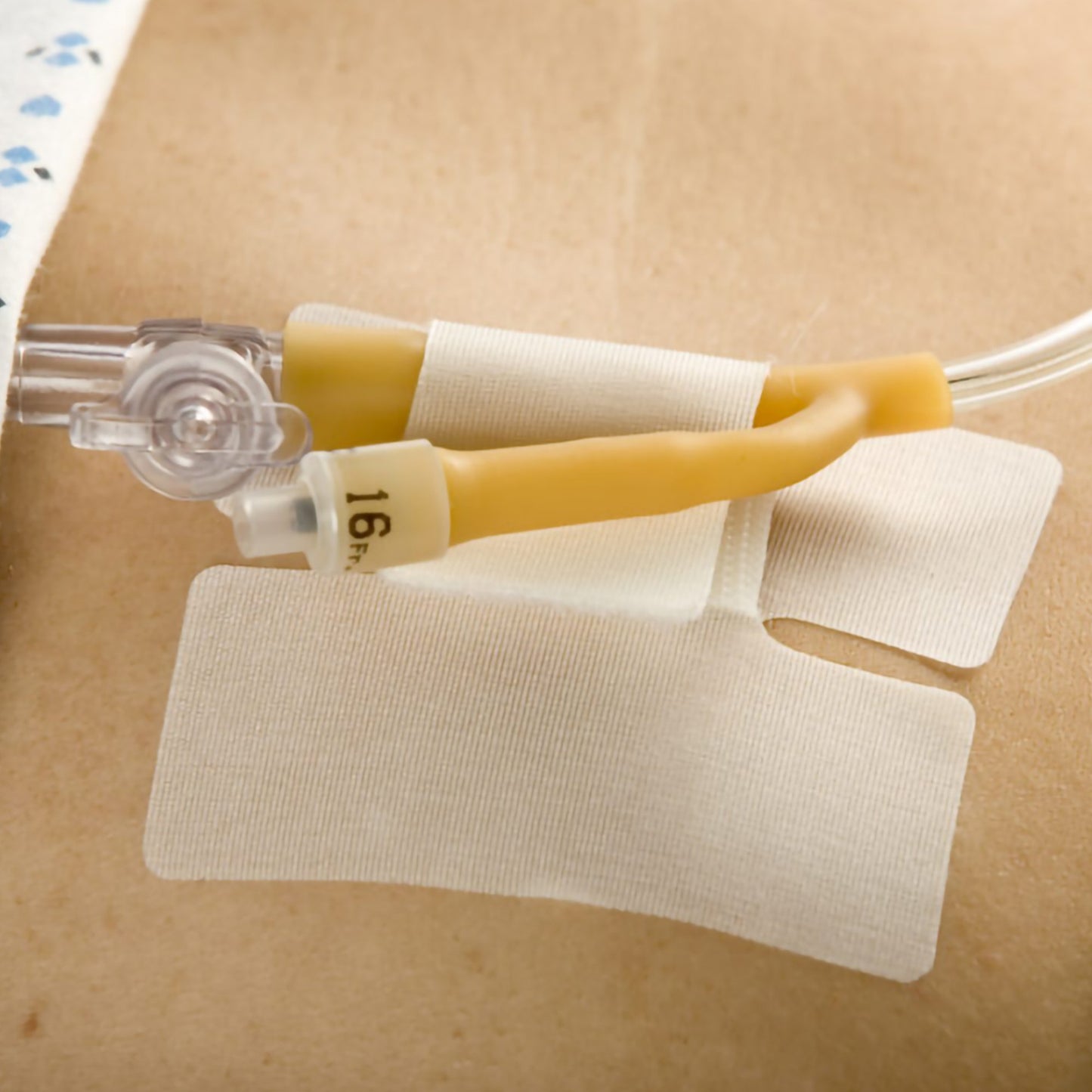 Multi-Purpose Tube Securement Cath-Secure